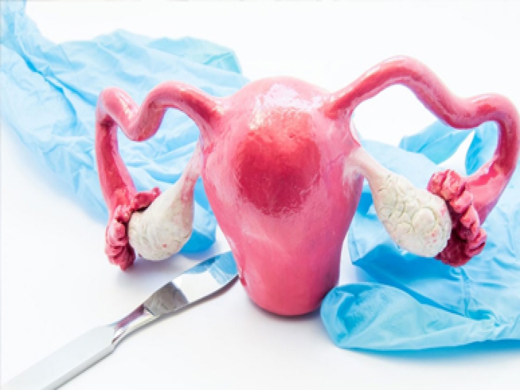 Histerektomi (Rahim Alma Operasyonu)